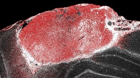 Человеческие мини-мозги прижились в зрительной коре крыс и среагировали на мигание